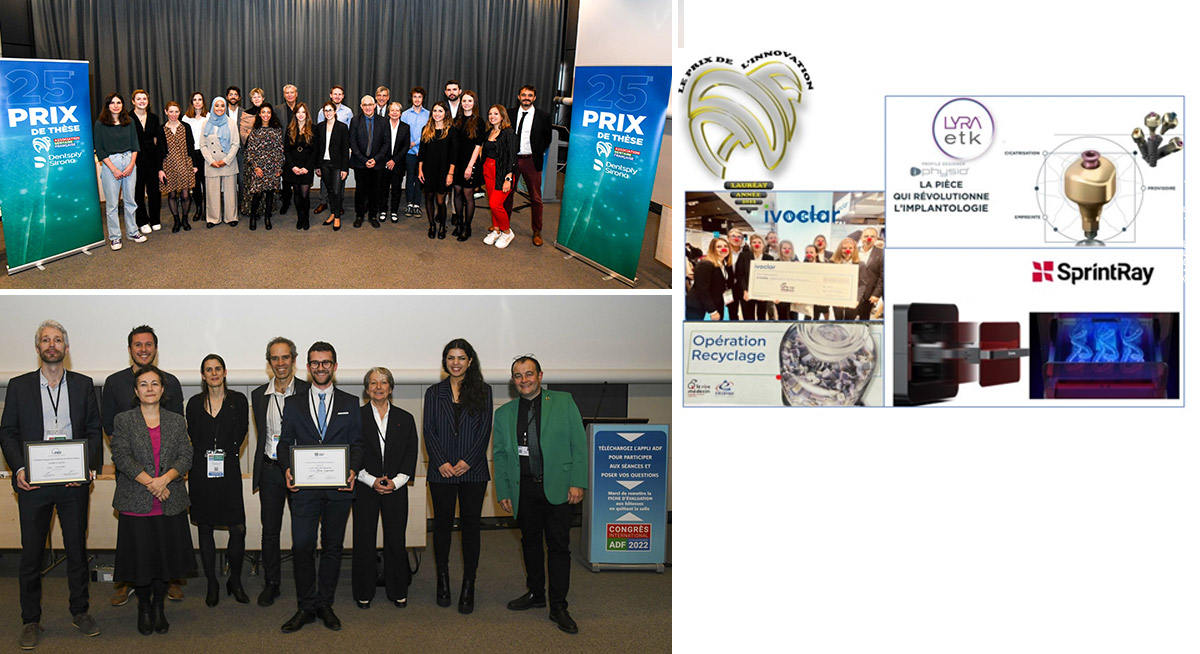 Prix ADF 2022